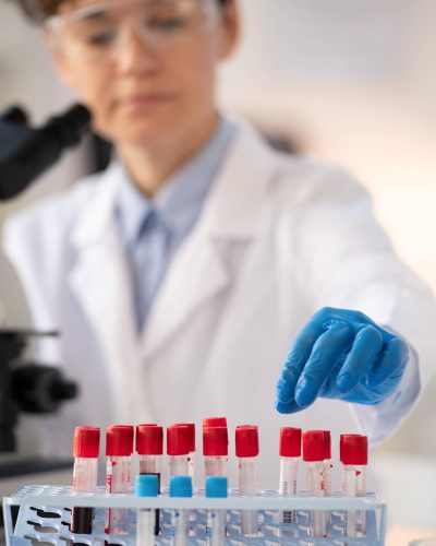 sorting-blood-samples-in-rack-HFX268K (1)